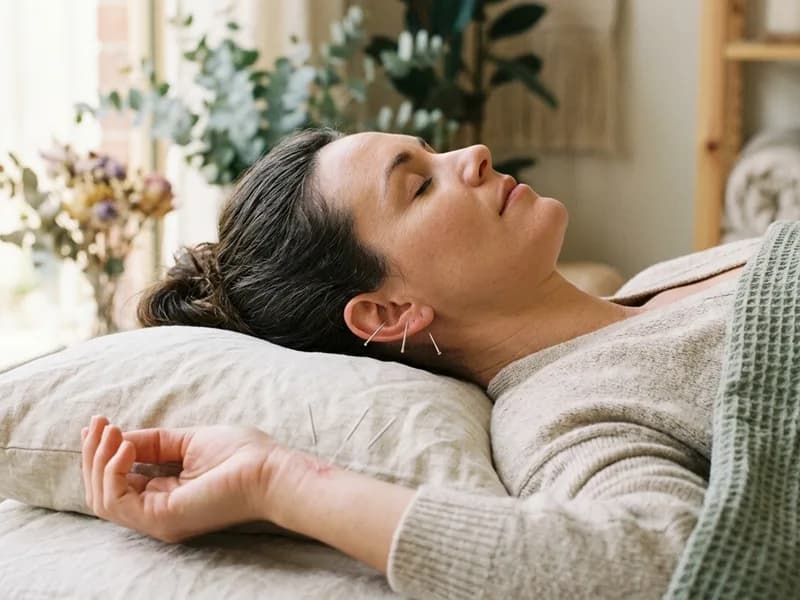 Editorial photograph of acupuncture needles at the wrist and ear for stress and burnout relief