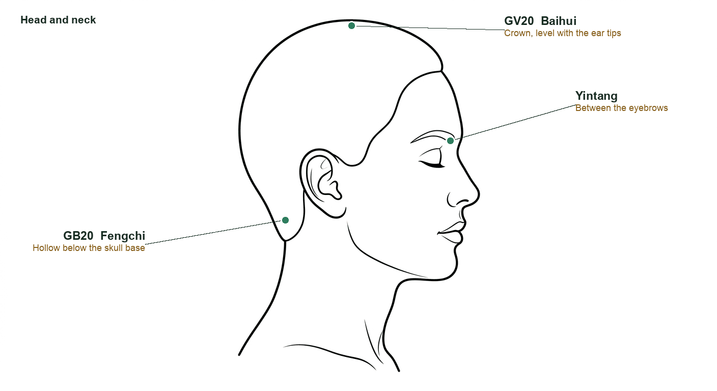 Head in profile with GV20 at the crown, Yintang between the brows and GB20 below the skull base