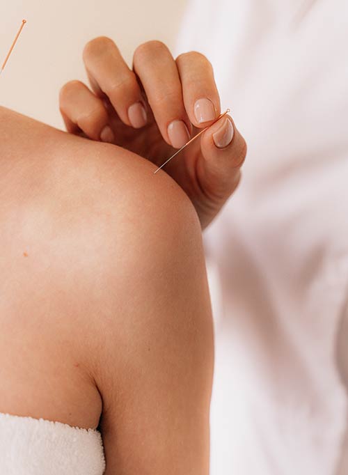 LA-acupuncture LA Acupuncture