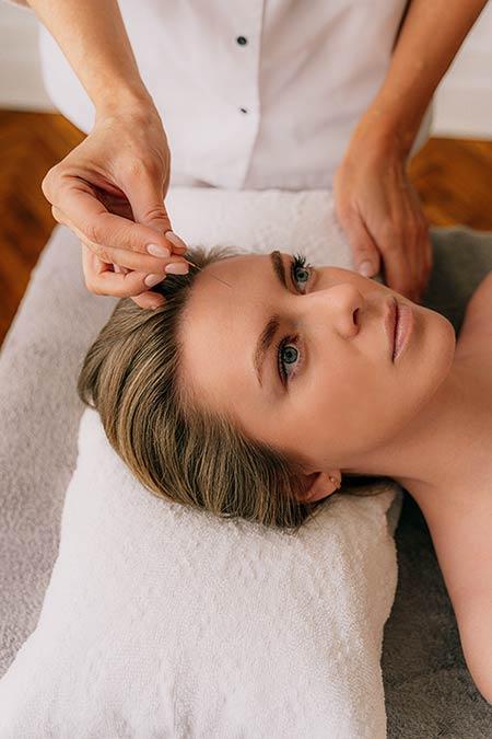 beauty-acupuncture beauty acupunture