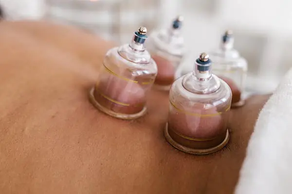 Los Angeles Hijama