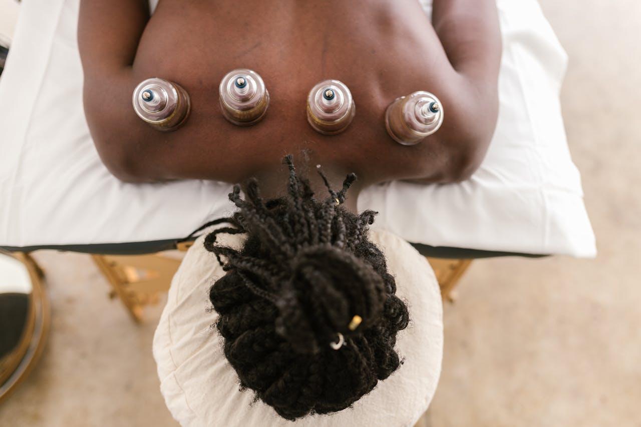 Cupping Therapy for Athletes