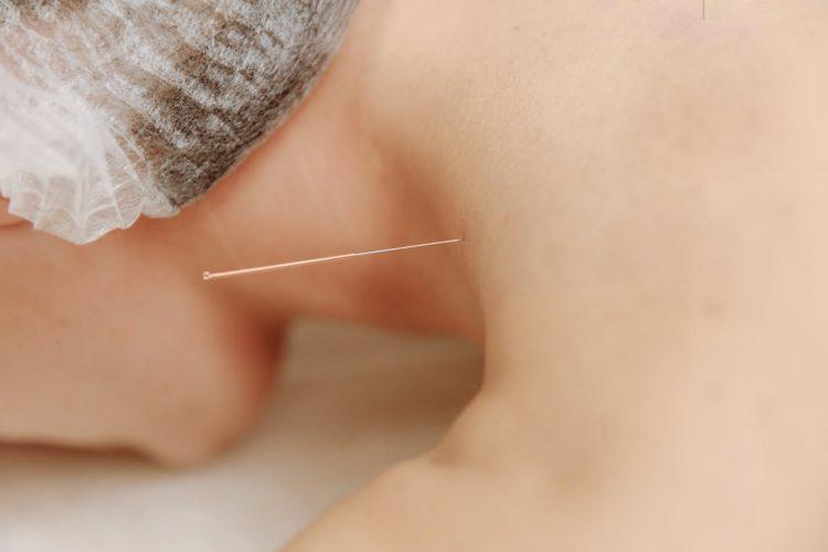 acupuncture and massage near me