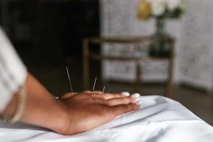 acupuncture side effects