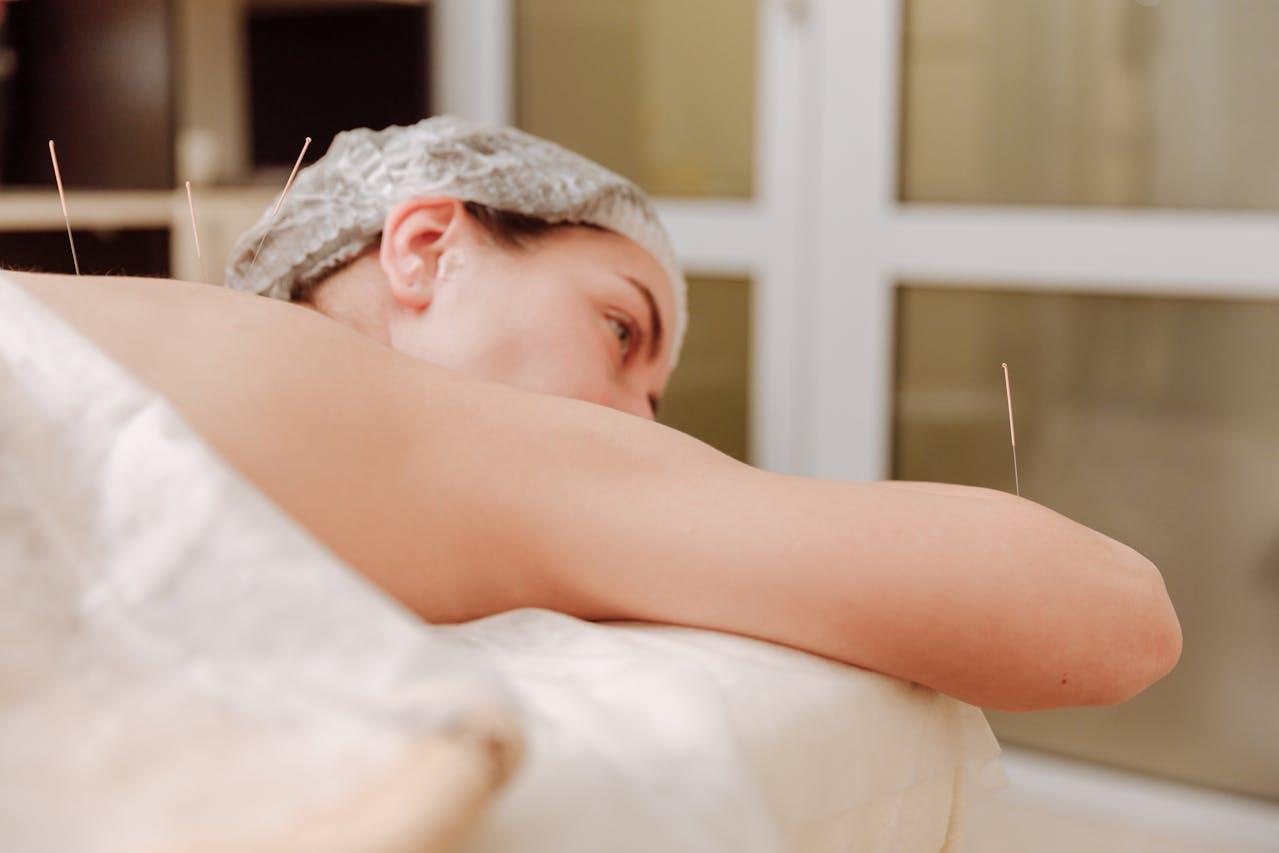 Is Acupuncture Safe