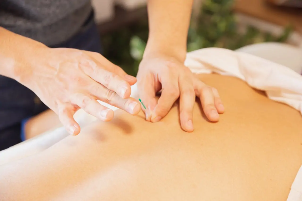 Local Acupuncturist